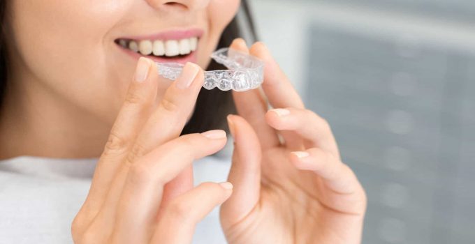 Are Invisible Braces Worth The Extra Cost