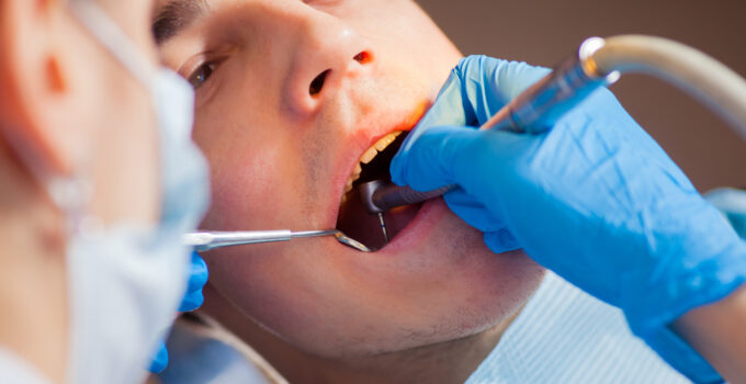 Which Oral Sedation is the Best?