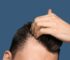 Signs of Low Testosterone Every Man Should Know